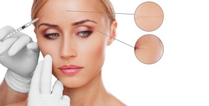 11 Întrebări și răspunsuri cu privire la Botox, Centrul de plastic de san - st Dickov (Botox) 11 Întrebări și răspunsuri cu privire la Botox, san plastic Center - st Dikov