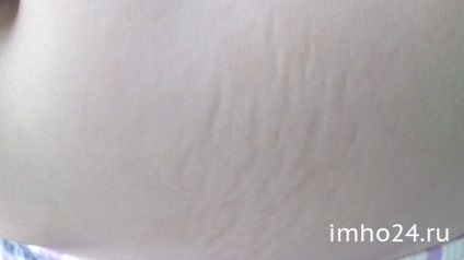 9 luni pentru comentarii crema de corecție extensii (luni) 9 luni crema pentru vergeturi corecție comentarii