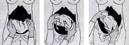 rotate obstetric (turn) cefalic