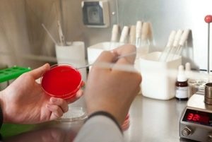 Alergice simptome blefarită, diagnostic, tratament (tratament) simptome alergice blefarită, diagnostic, tratament