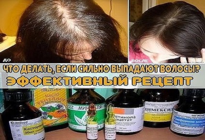 Secretele bunicii Cum să crească părul lung și gros în doar o lună - rețeaua - Luminează-te! (Frământat) Secretele bunicii Cum să crească părul lung și gros în doar o lună - rețeaua - Luminează-te!