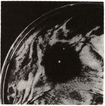 microbi patogeni (bacterii) microbi patogeni