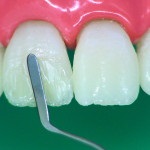 Revista dentare (dentare) revista Dental