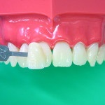 Revista Dental (clasa țesut tare) revista Dental