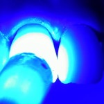 Revista Dental (clasa țesut tare) revista Dental