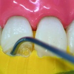 Revista dentara (a dintilor anteriori) revista Dental