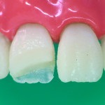 Revista Dental (clasa țesut tare) revista Dental