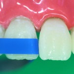 Revista dentare (dentare) revista Dental
