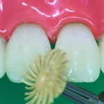 Revista dentare (dentare) revista Dental