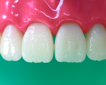 Revista dentara (a dintilor anteriori) revista Dental