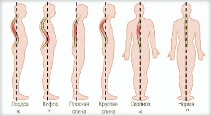 exerciții eficiente pentru postura la domiciliu (exercițiu) exerciții eficiente pentru postura la domiciliu