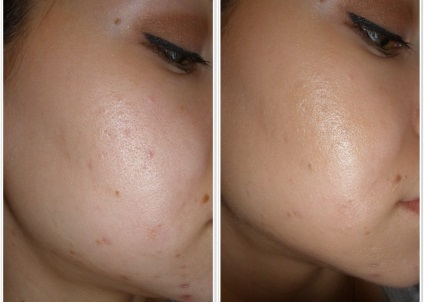 Recenzii Emolium crema (Instrucțiuni de utilizare) (instrucțiuni) Recenzii Emolium crema (Instrucțiuni de utilizare)