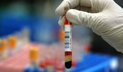 Hipoplazia pentru tratamentul testicular (testicul) Hipoplazie testiculelor pentru a trata