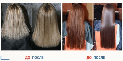 păr Glam (căderea părului) Glam păr