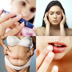 Descriere Grifola și proprietăți utile, produse alimentare și de sănătate (împotriva cancerului) descriere și utile Grifola proprietăți, produse alimentare și de sănătate