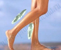 Implanturile tibia (implanturi shin) implanturi fluierul piciorului