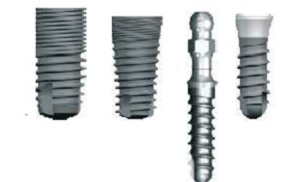 Implanturile CONMET (CONMET) beneficii, instalare, preț real (implanturi Conmet comentarii) Implanturile CONMET (CONMET) beneficii, instalare, comentarii, pret