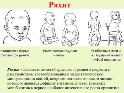 Suplimente de calciu concepute pentru copii (calciu) Suplimente de calciu destinate copiilor