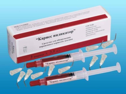 Cum se utilizează carii de marcare (prevenirea cariilor) Cum să utilizați marcator cariilor dentare
