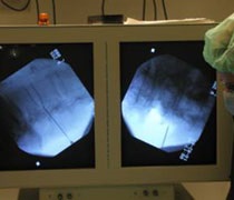 Klinik und poliklinik fuer neurochirurgie informații pacient (neurochirurgie) Klinik und poliklinik fuer neurochirurgie informații pacient