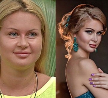 Numărul de ovule în corpul feminin (feminin) Numărul de ouă în organism de sex feminin