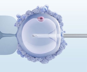 Numărul de ovule în corpul feminin (feminin) Numărul de ouă în organism de sex feminin