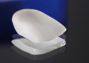 Compozit bretele că o astfel de estetic compozit acolade comentarii de preț (compozit) acolade material compozit care astfel estetic compozit acolade comentarii preț