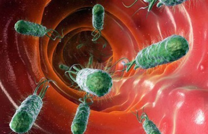 Cursul tratamentului ulcerului duodenal 12 al primului simptom (12-) Cursul tratamentului ulcerului duodenul 12 al primului simptom