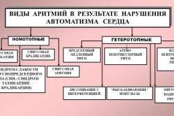 Terapia Exercitarea în infarctul miocardic (atac de cord) Terapia Exercitarea în infarctul miocardic
