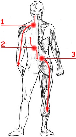 diagnostic și frământare unități manuale miogeloza pentru dureri de spate
