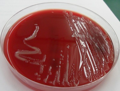 patogen antimeningococic boala, epidemiologia, patogeneza, imunitate (Epidemiologie) Antimeningococic patogen bolii, epidemiologie, patogeneza, imunitatea