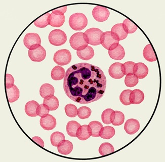 patogen antimeningococic boala, epidemiologia, patogeneza, imunitate (Epidemiologie) Antimeningococic patogen bolii, epidemiologie, patogeneza, imunitatea