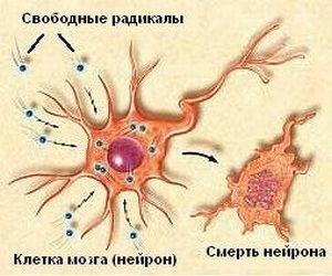 Oxidative stress stări patologice și boli, care provoacă, biochimie (oxidativă) Oxidative stress stări patologice și boli, care provoacă, biochimie