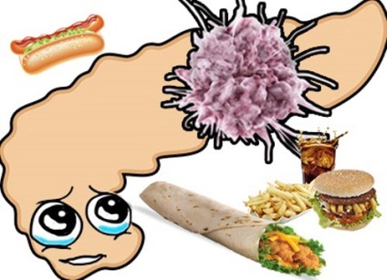 Obezitatea pancreas, pancreatita (pancreatic) pancreas obezitate, pancreatita