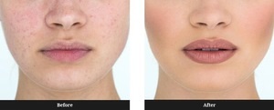 Permanent specii buze machiaj, recenzii, cosmetologi fotografie tatuaj înainte de procedura și după vindecare (comentarii) Permanent specii buze machiaj recenzii cosmetologi, tatuaj fotografie înainte de procedură, după vindecare