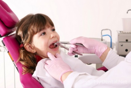 Pierderea ulterioară a dinților de foioase care fac (dinți) Pierderea ulterioară a dinților temporari care fac