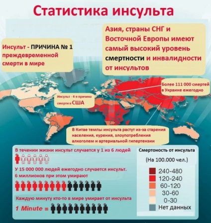 accident vascular cerebral STADIUL la bărbați și femei (bărbați) accident vascular cerebral STADIUL la bărbați și femei