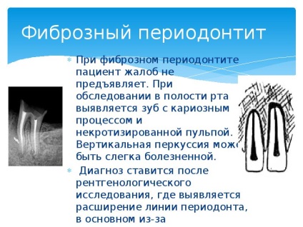 Prezentarea pe parodontita (prezentare) Prezentare pe parodontită