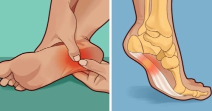 consecințe calcaneană pinten ce se va întâmpla dacă sunt lăsate netratate (pinten) consecințe calcaneană pinten ce se va întâmpla dacă sunt lăsate netratate