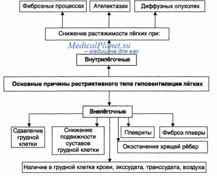 Tipul restrictiv hipoventilației alveolară (restrictiv) tip restrictiv de hipoventilație alveolară