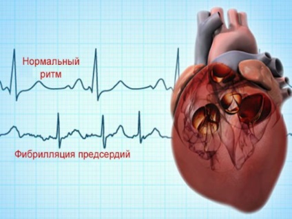 Sindromul Frederick - cauze, simptome si tratament (cauza) Sindromul Frederick - cauze, simptome și tratament