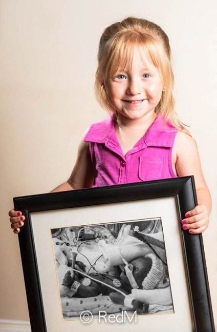 De-a lungul anilor, atingând fotografii ale bebelușilor născuți prematur (eva) De-a lungul anilor, atingându fotografii ale copiilor născuți prematur