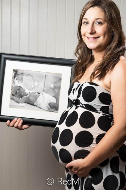 De-a lungul anilor, fotografii ale bebelușilor născuți prematur atingând (știri) De-a lungul anilor, atingându fotografii ale copiilor născuți prematur