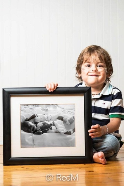 De-a lungul anilor, atingând fotografii ale bebelușilor născuți prematur (nou-născuți prematuri) De-a lungul anilor, atingându fotografii ale copiilor născuți prematur
