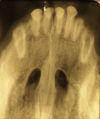 Stomatologie pentru animale este la fel de importantă ca și pentru noi, articolul (de-a lungul liniei gingivale) Stomatologie pentru animale este la fel de important cum este pentru noi, articolul
