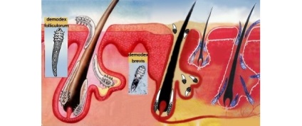 Acarienii urechii la om, care este un risc si tratament, dezinfectie si deratizare - (ureche) ureche acarieni la oameni, care este un risc si tratament, dezinfectie si deratizare -