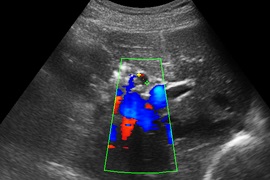 Uzi Permian, inima, ecografie pelvină în Permian, cu ultrasunete a abdomenului și a organelor interne Permian (diagnosticare lânii) Uzi Permian, inima, ecografie pelvină în Permian, cu ultrasunete a organelor interne abdomenului și Permian
