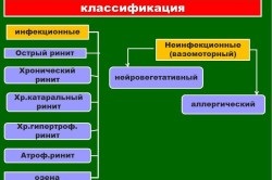 Simptomele rinitei virale (primul pe podea) Simptomele rinitei virale