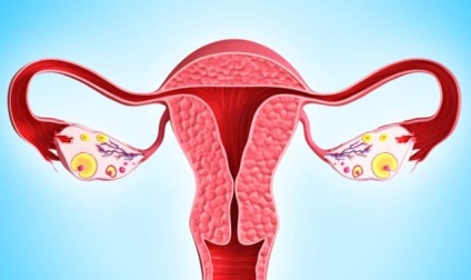 endometrita cronică - simptomele și tratamentul bolii (boala) Endometrioza cronice - simptome si tratamentul bolii