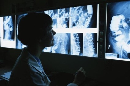 Fatty pancreas (opțional) infiltrarea grasă a pancreasului